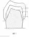Fig. 02 -  METHOD OF DESIGNING A TOOTH REPLACEMENT PART, A METHOD OF PROCESSING A DESIGNED TOOTH REPLACEMENT PART, A TOOTH REPLACEMENT PART, AND A COMPUTER-READABLE MEDIUM