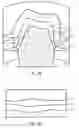 Fig. 08 -  METHOD OF DESIGNING A TOOTH REPLACEMENT PART, A METHOD OF PROCESSING A DESIGNED TOOTH REPLACEMENT PART, A TOOTH REPLACEMENT PART, AND A COMPUTER-READABLE MEDIUM