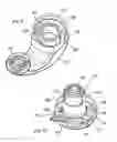 Fig. 07 - Tensioner for flexible drives