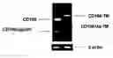 Fig. 01 - IDENTIFICATION OF NEW ISOFORMS OF THE MHC-CLASS I SPECIFIC RECEPTOR CD160 AND USES THEREOF