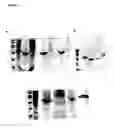 Fig. 07 - Methods for separating recombinant proteins in aqueous two-phase systems