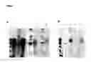 Fig. 08 - Methods for separating recombinant proteins in aqueous two-phase systems