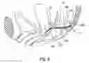 Fig. 06 - METHOD OF TREATMENT OF PROLAPSES