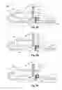 Fig. 08 - Self-contained handheld biopsy needle
