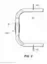 Fig. 03 - Self adjusting venous equalizing graft