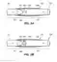 Fig. 05 - Self adjusting venous equalizing graft