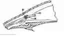 Fig. 01 - DUAL DRAINAGE PATHWAY SHUNT DEVICE