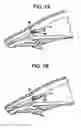 Fig. 08 - DUAL DRAINAGE PATHWAY SHUNT DEVICE