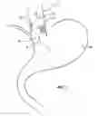 Fig. 02 - Methods and systems for determining physiologic characteristics for treatment of the esophagus