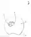 Fig. 07 - Articulation apparatus for external fixation device