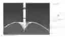 Fig. 01 - Device and method for deflation and removal of implantable and inflatable devices