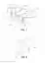 Fig. 02 - ELECTROMECHANICAL TOURNIQUET FOR BATTLEFIELD APPLICATION