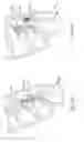 Fig. 06 - Surgical tether apparatus and methods of use