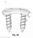 Fig. 09 - Dynamic vertebral column plate system