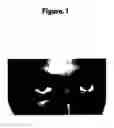 Fig. 02 - Treatment of vitiligo