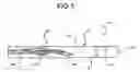 Fig. 06 - Detachable And Retrievable Stent Assembly