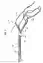 Fig. 08 - Detachable And Retrievable Stent Assembly