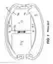 Fig. 02 - Linear drive and pump system, in particular an artificial heart