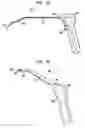 Fig. 09 - Implant systems and methods for treating obstructive sleep apnea