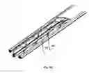 Fig. 07 - IMPLANTED MEDICAL DEVICE ESPECIALLY USED IN COSMETIC SURGERY