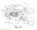 Fig. 07 - Expendable intervertebral implant and associated instrumentation