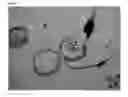Fig. 02 - Seed treatment with PRF