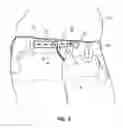Fig. 09 - Method and apparatus for accommodating and covering of varying abdomen
