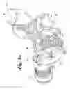 Fig. 09 - Support assembly for a surface treating appliance