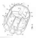 Fig. 03 - Transmission gear train baffle