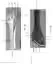 Fig. 02 - Tailpiece for a musical instrument