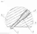 Fig. 04 - Glow plug having coking-optimized design