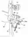 Fig. 01 - Archery Bow Bracket