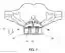 Fig. 08 - Asymmetrical and complexly-curved, passive, device for relieving back and spinal postural mechanical pain