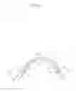Fig. 29 - WEARER'S OWN HAIR UTILIZING TYPE WIG