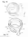 Fig. 09 - Cylindrical dedusting apparatus for particulate material