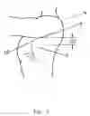 Fig. 08 - Ambulation Assistance Apparatus and Methods