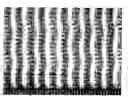 Fig. 01 - Creped tissue sheets treated with an additive composition according to a pattern