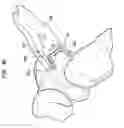 Fig. 08 - Method and apparatus for delivering a shape memory article to a surgical site