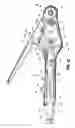 Fig. 05 - End-to-end anastomosis instrument and method for performing same