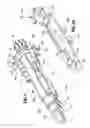 Fig. 07 - End-to-end anastomosis instrument and method for performing same