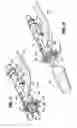 Fig. 16 - End-to-end anastomosis instrument and method for performing same