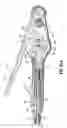 Fig. 20 - End-to-end anastomosis instrument and method for performing same