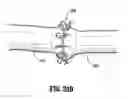 Fig. 25 - End-to-end anastomosis instrument and method for performing same