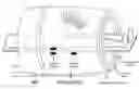 Fig. 01 - Method and device for image guided dynamic radiation treatment of prostate cancer and other pelvic lesions