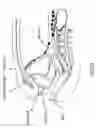 Fig. 04 - Method and device for image guided dynamic radiation treatment of prostate cancer and other pelvic lesions