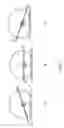 Fig. 08 - Method and device for image guided dynamic radiation treatment of prostate cancer and other pelvic lesions