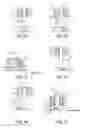 Fig. 06 - Semiconductor device and wire bonding method