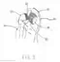 Fig. 06 - Means of keeping a disabled child's head upright