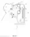 Fig. 02 - Orthovoltage radiosurgery