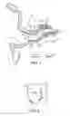 Fig. 02 - Tool for insertion and removal of in-canal hearing devices